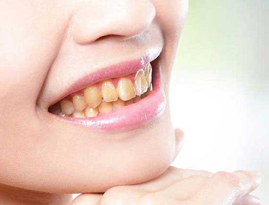 Teeths before treatment with Upkar Dental Clinic