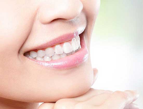 Teeths after treatment with Upkar Dental Clinic